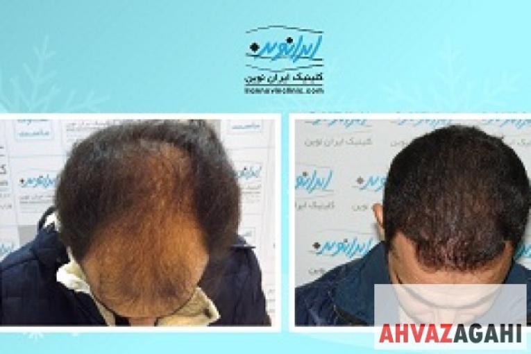 کلینیک فوق تخصصی ایران نوین